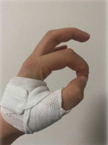 手指対立スプリント